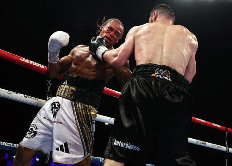 Anthony Yarde Says He Wants Joshua Buatsi, Artur Beterbiev Rematch, Dmitry Bivol