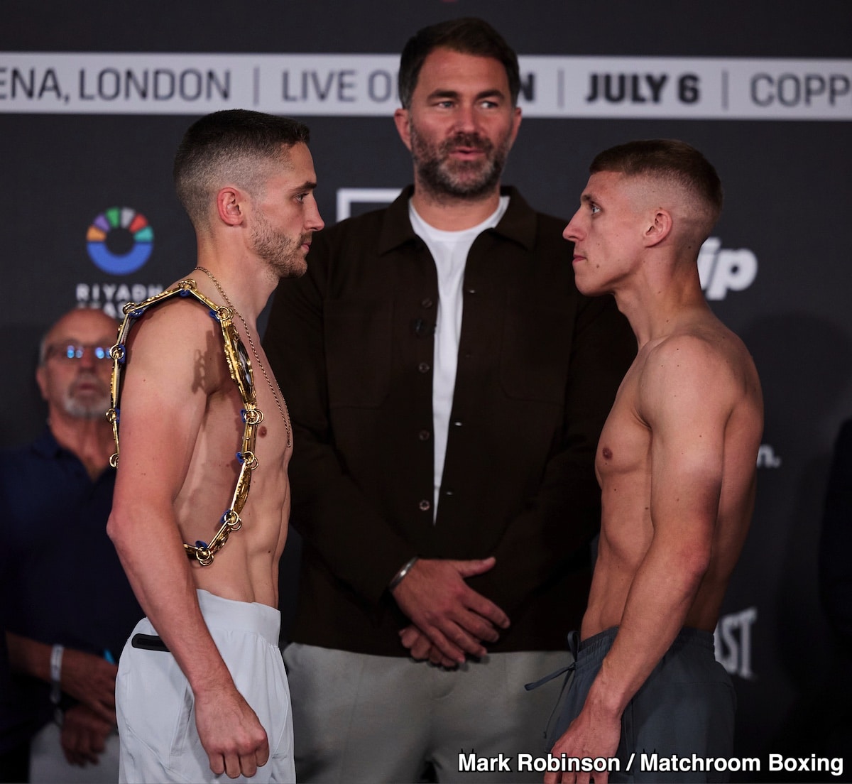 Alen Babic, Johnny Fisher Weigh-In; Babic Says He Hopes “We're Going To Spend Weeks In Hospital”